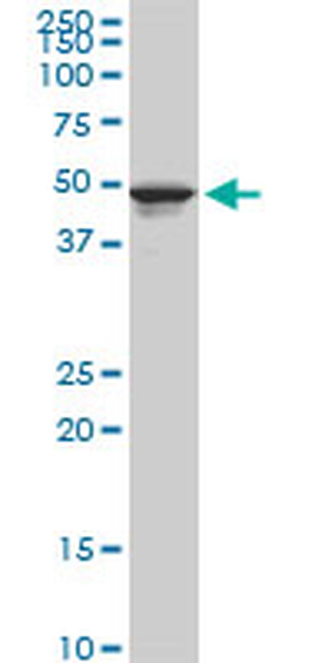 TPBG Antibody in Western Blot (WB)