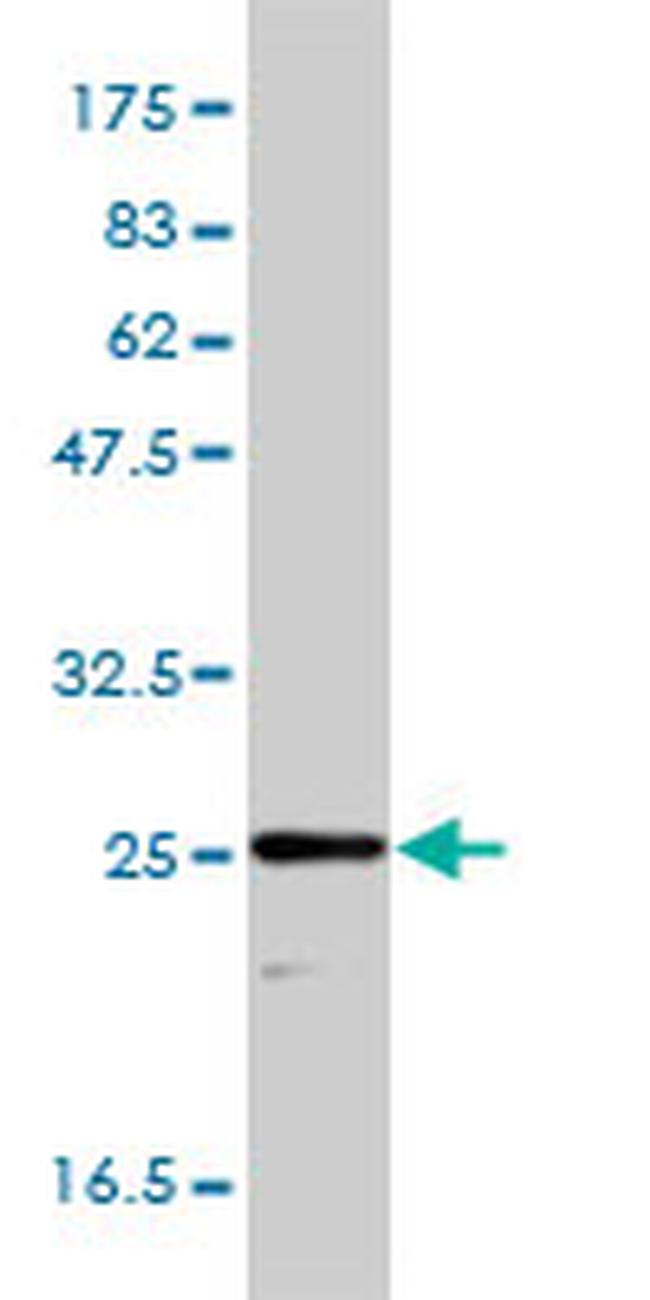 TPI1 Antibody in Western Blot (WB)