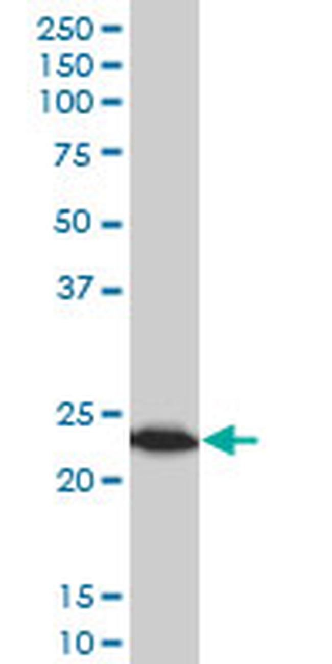 TPT1 Antibody in Western Blot (WB)