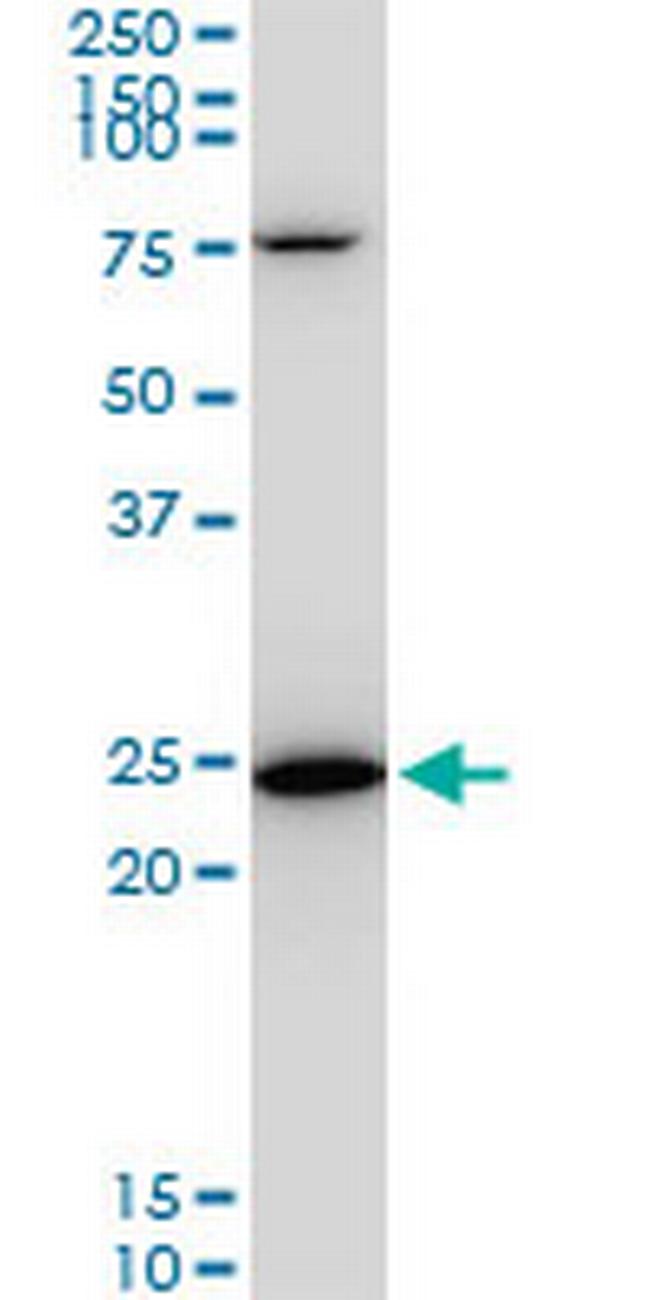 TPT1 Antibody in Western Blot (WB)