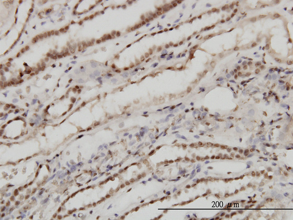 TSG101 Antibody in Immunohistochemistry (Paraffin) (IHC (P))