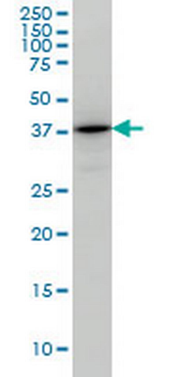 TSTA3 Antibody in Western Blot (WB)