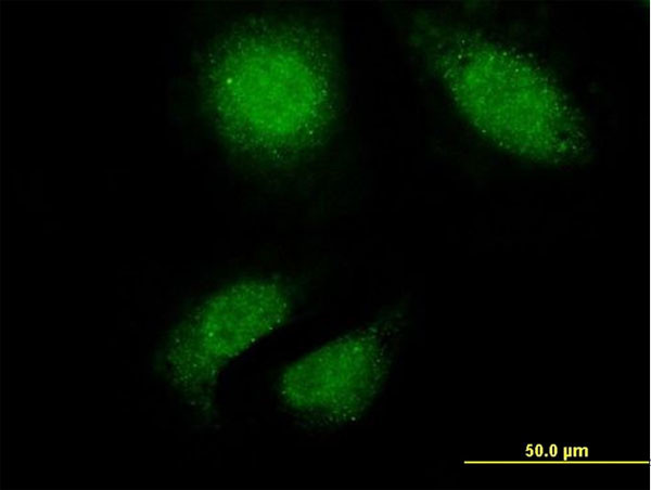 TTN Antibody in Immunocytochemistry (ICC/IF)