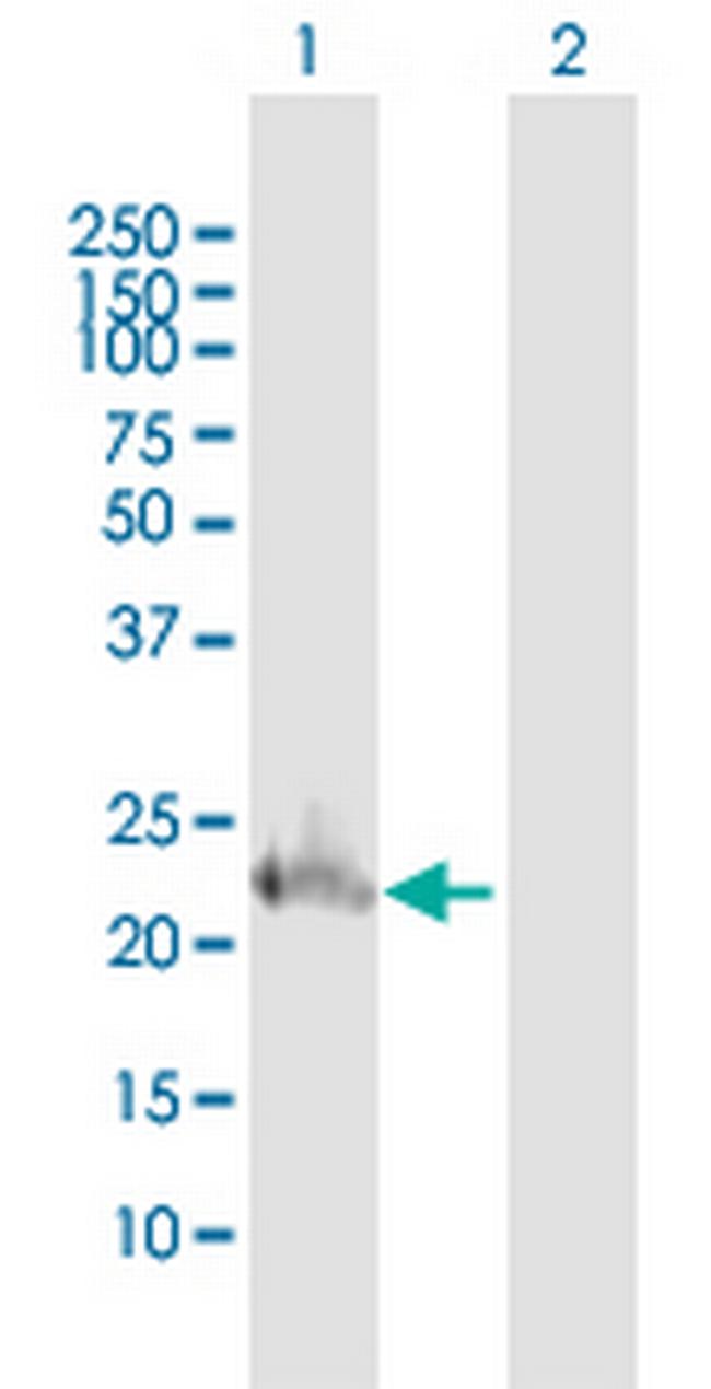 TWIST1 Antibody in Western Blot (WB)