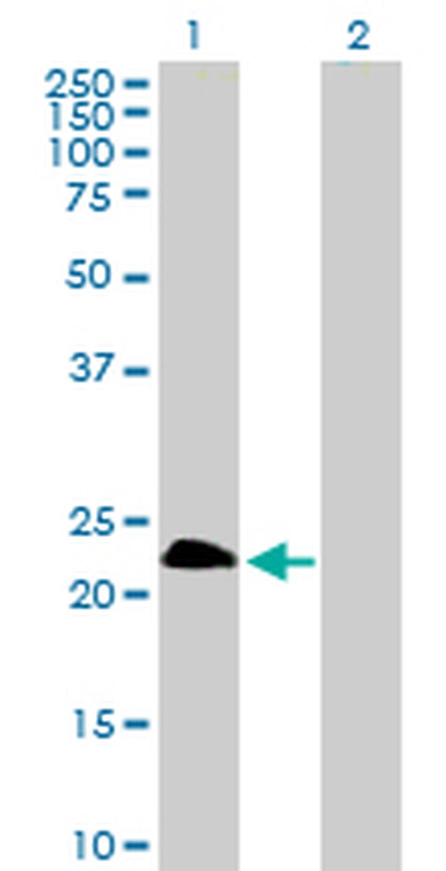 TWIST1 Antibody in Western Blot (WB)