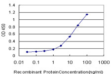 TWIST1 Antibody in ELISA (ELISA)