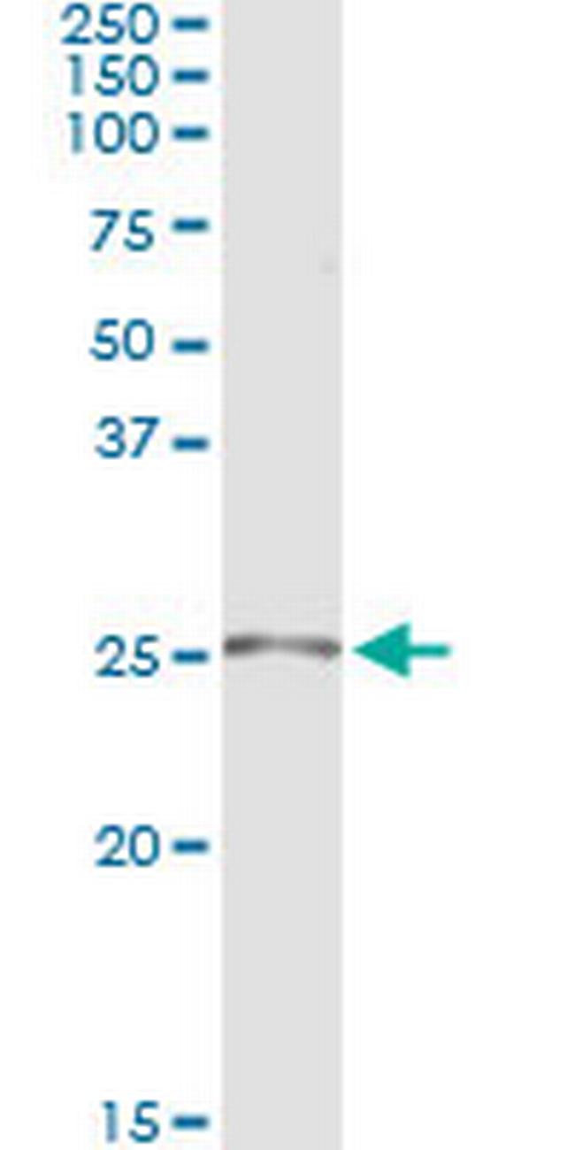 TWIST1 Antibody in Immunoprecipitation (IP)