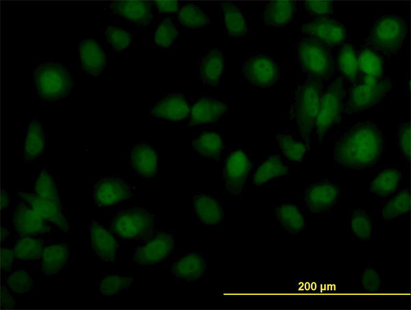 TYK2 Antibody in Immunocytochemistry (ICC/IF)