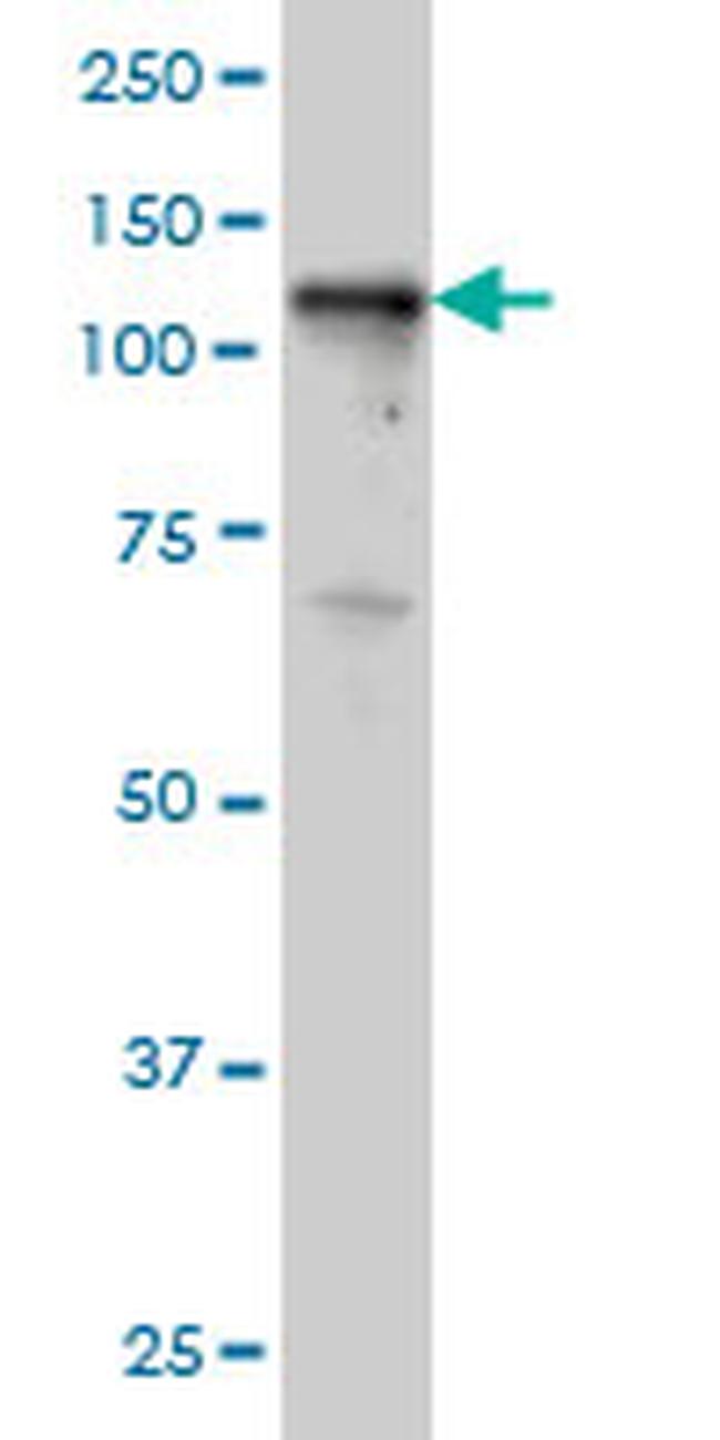 TYK2 Antibody in Western Blot (WB)