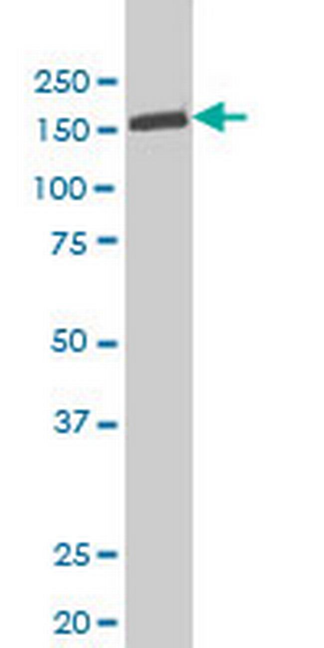 TYK2 Antibody in Western Blot (WB)