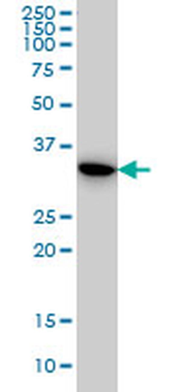 TYMS Antibody in Western Blot (WB)