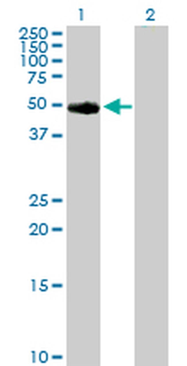 TYR Antibody in Western Blot (WB)