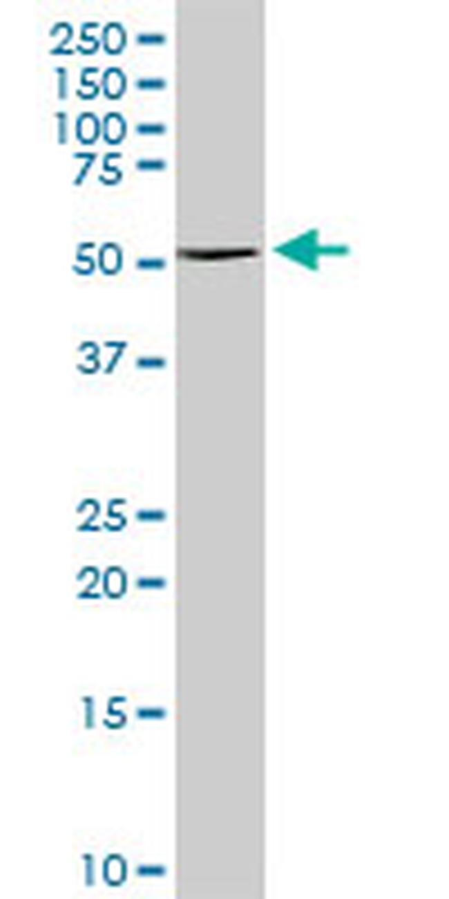 TYR Antibody in Western Blot (WB)