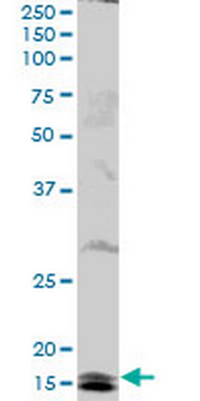 UBE2B Antibody in Western Blot (WB)