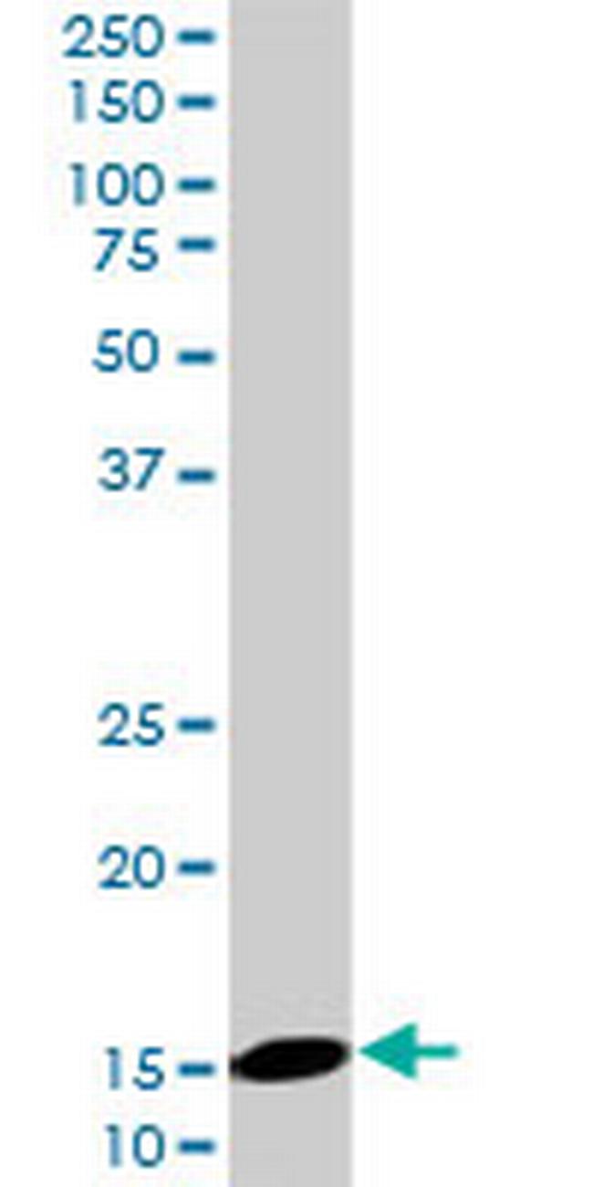 UBE2D2 Antibody in Western Blot (WB)