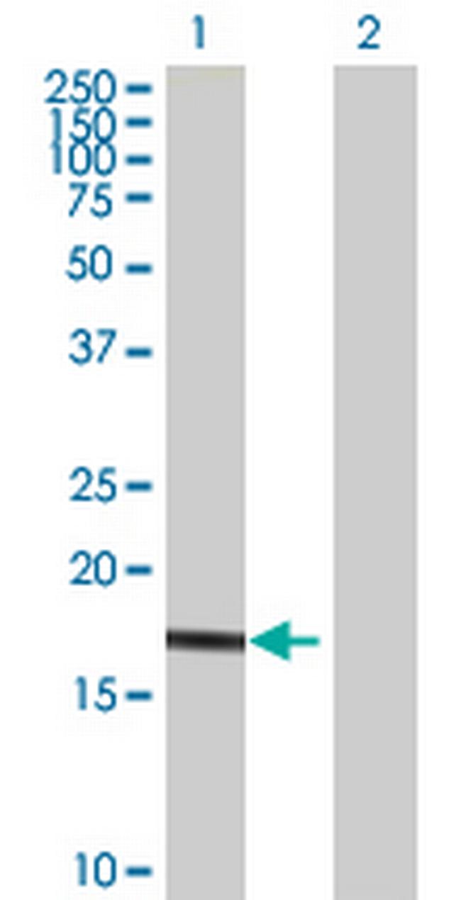 UBE2G1 Antibody in Western Blot (WB)
