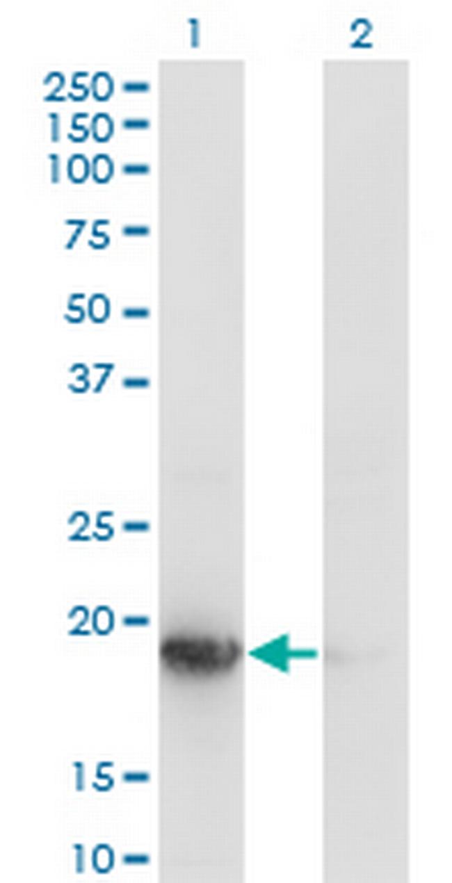 UBE2G1 Antibody in Western Blot (WB)