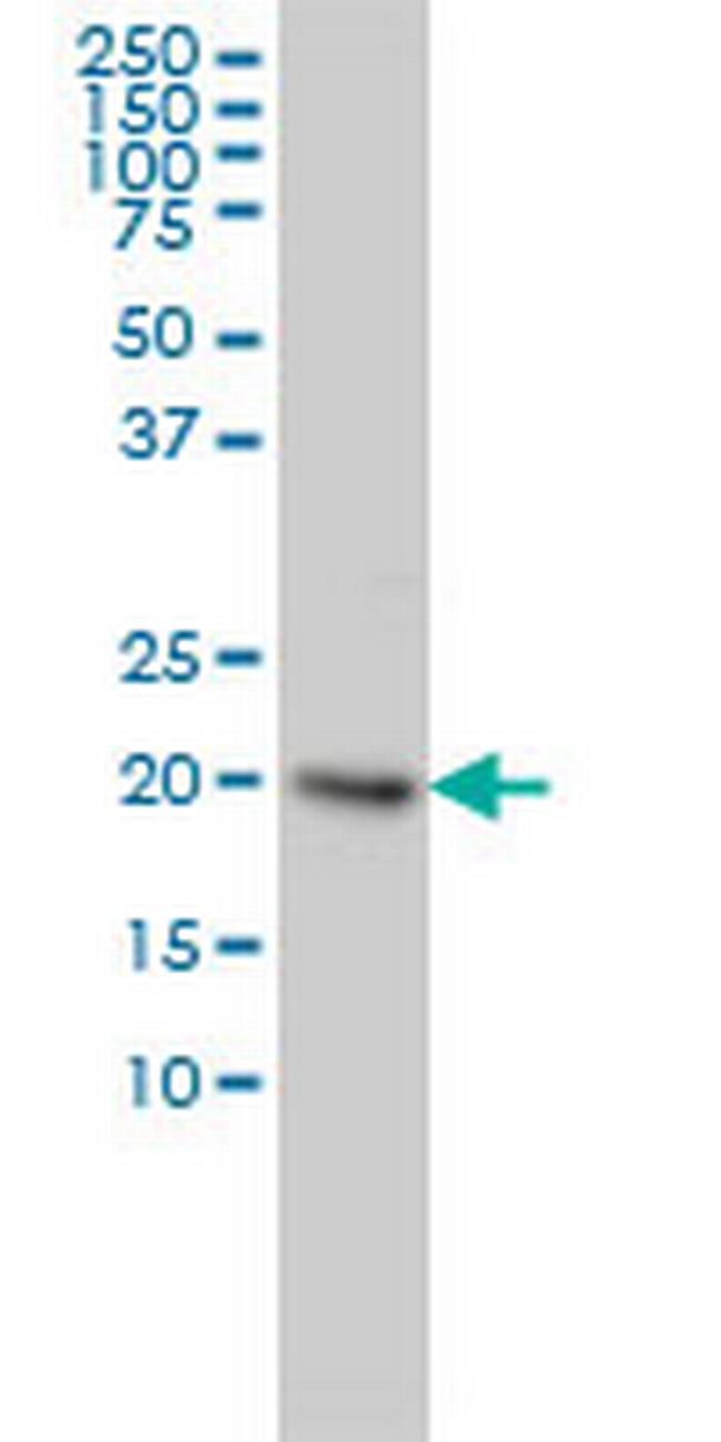 UBE2H Antibody in Western Blot (WB)