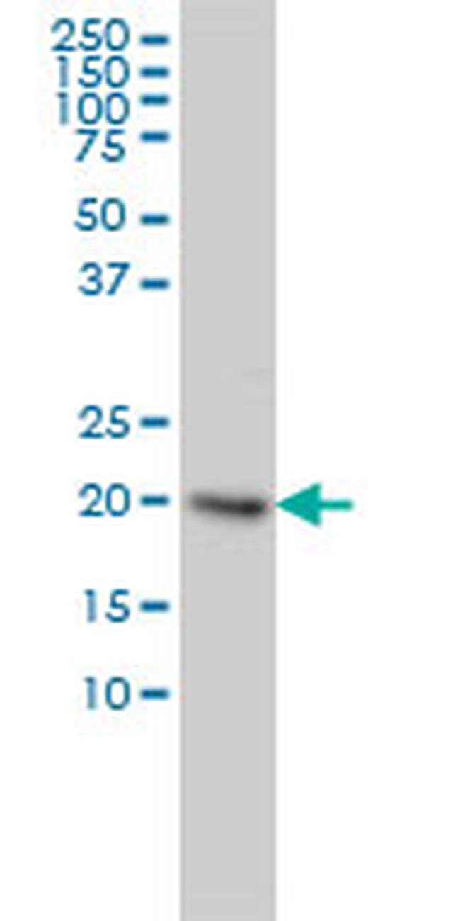 UBE2H Antibody in Western Blot (WB)