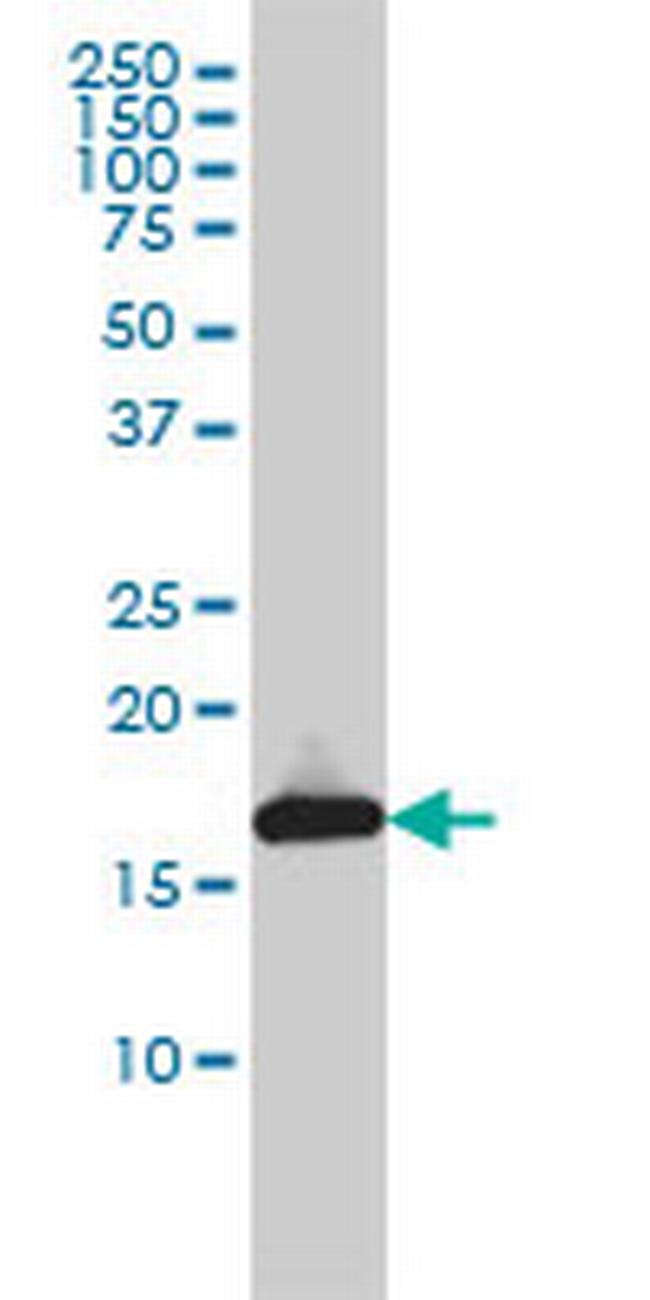 UBE2L3 Antibody in Western Blot (WB)