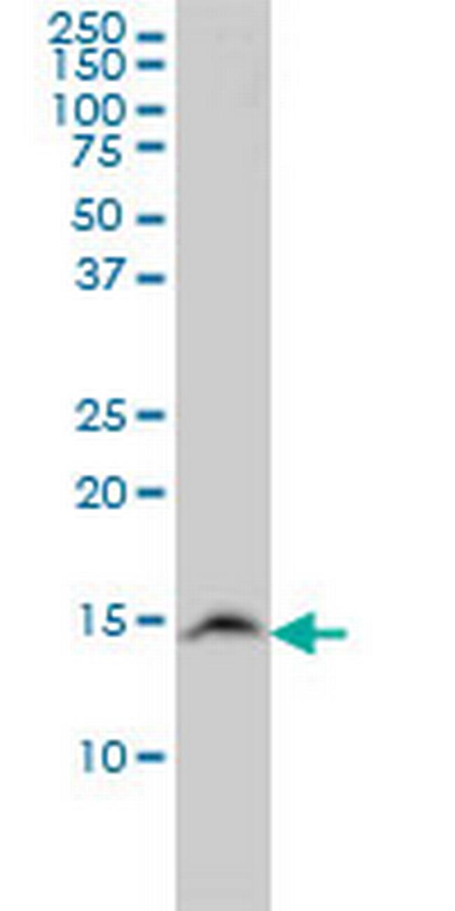 UBE2N Antibody in Western Blot (WB)