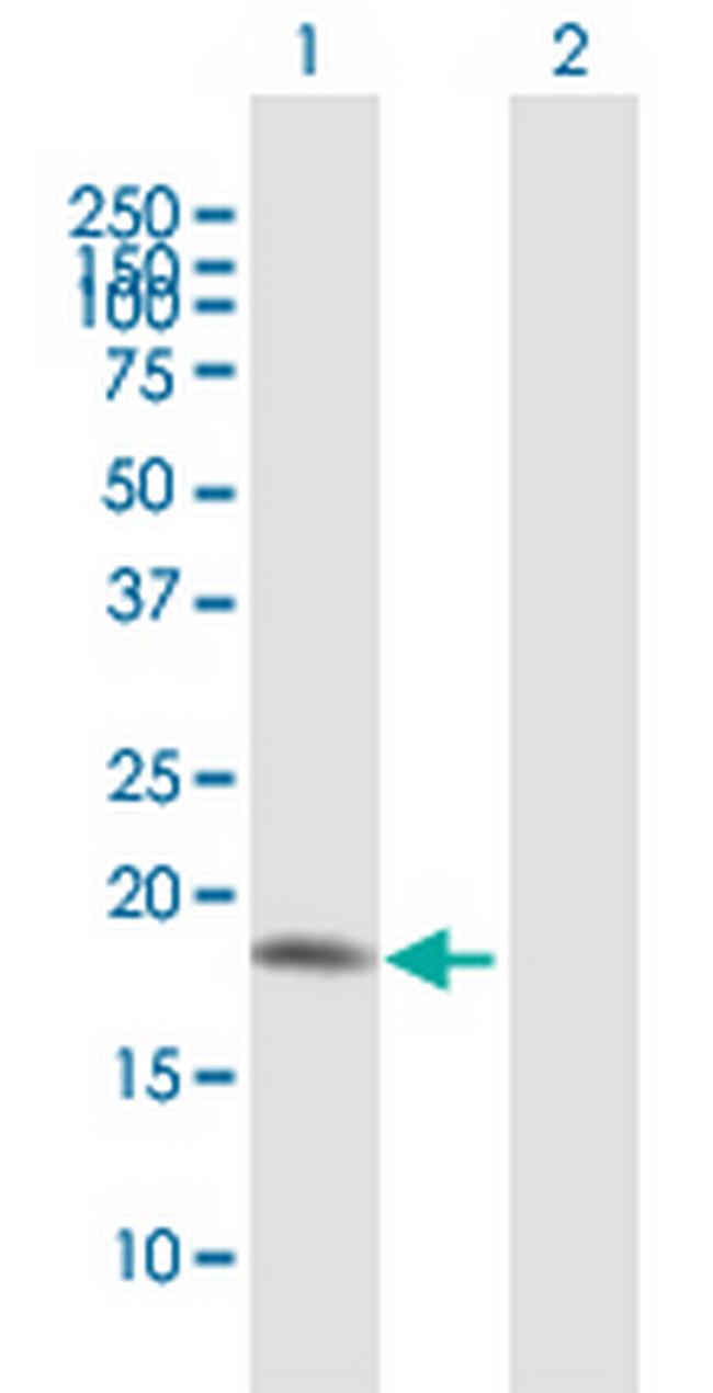 UBE2V2 Antibody in Western Blot (WB)