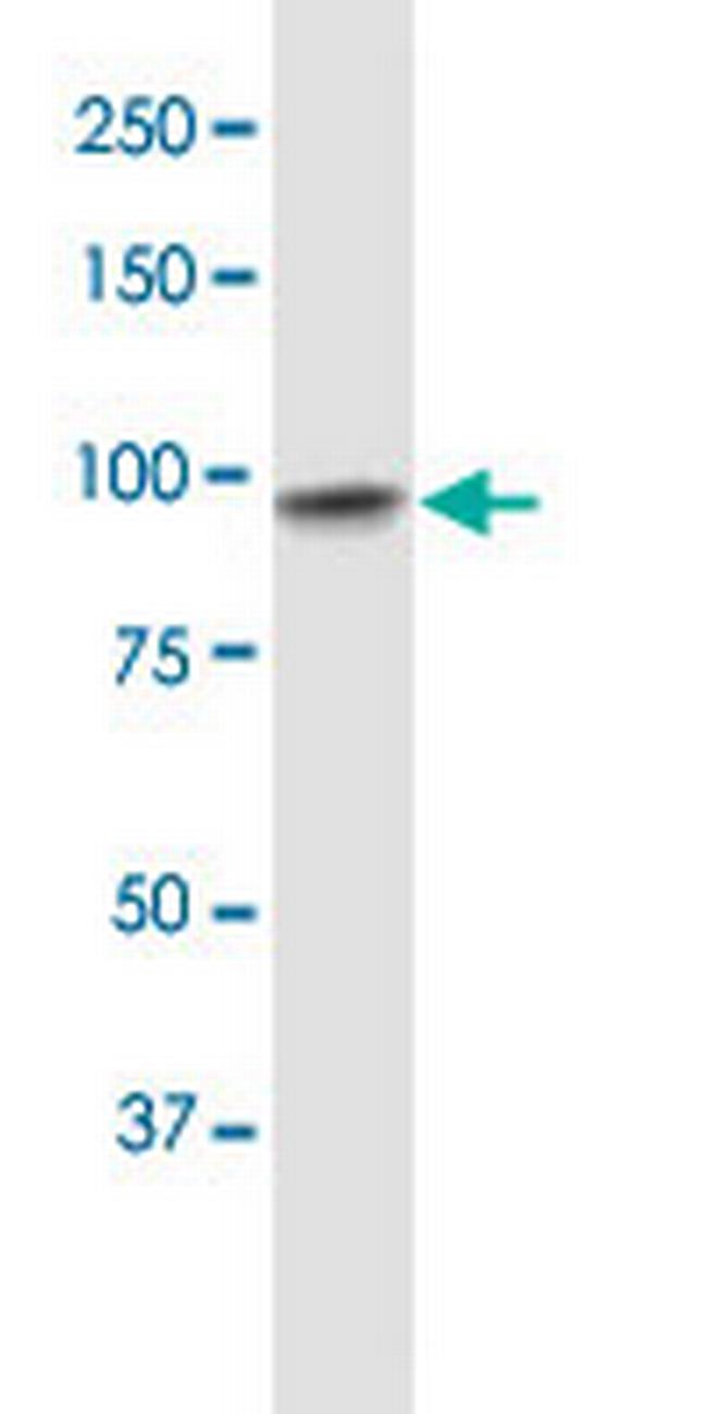 UBE3A Antibody in Western Blot (WB)