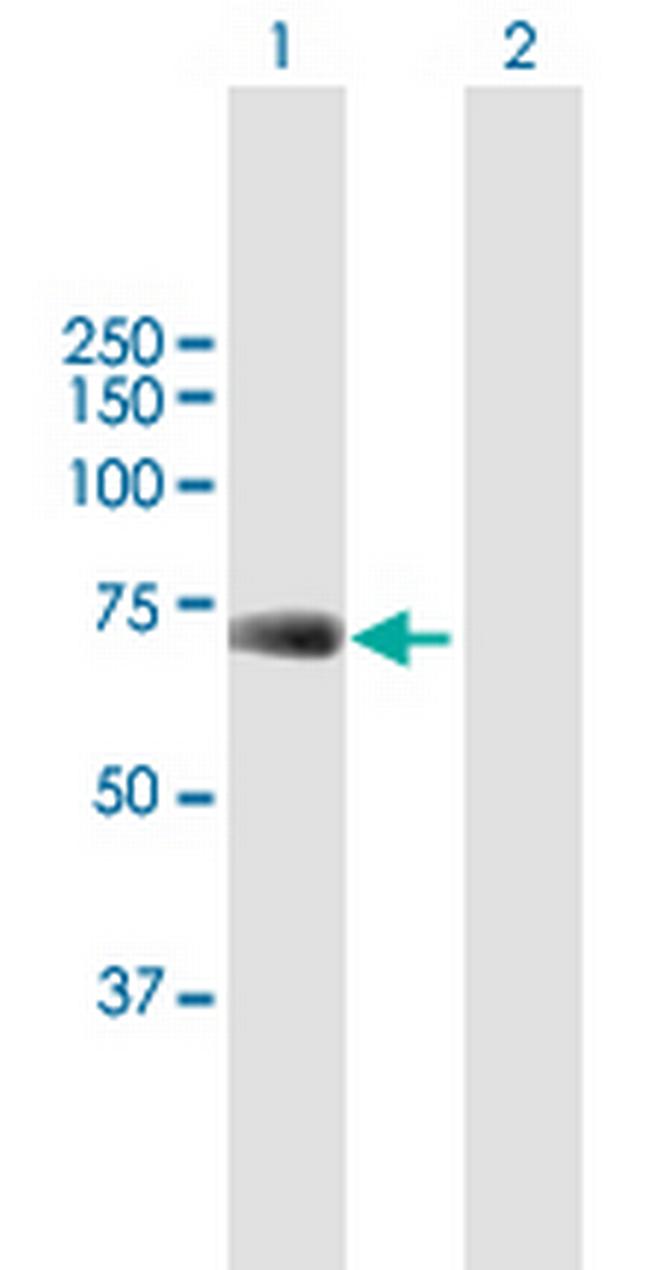 UBP1 Antibody in Western Blot (WB)