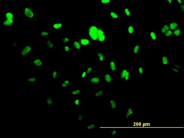 UBTF Antibody in Immunocytochemistry (ICC/IF)