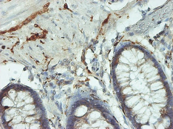 UCHL1 Antibody in Immunohistochemistry (Paraffin) (IHC (P))