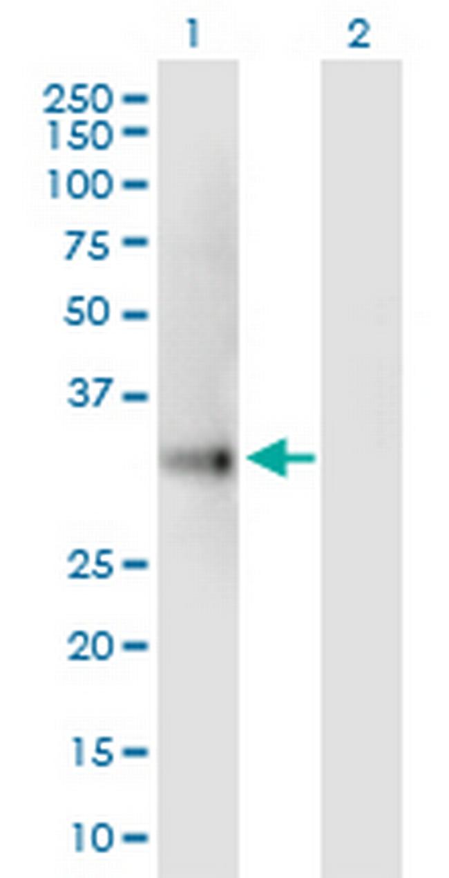 UCP2 Antibody in Western Blot (WB)