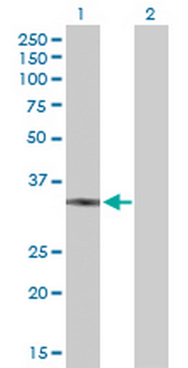 UCP2 Antibody in Western Blot (WB)