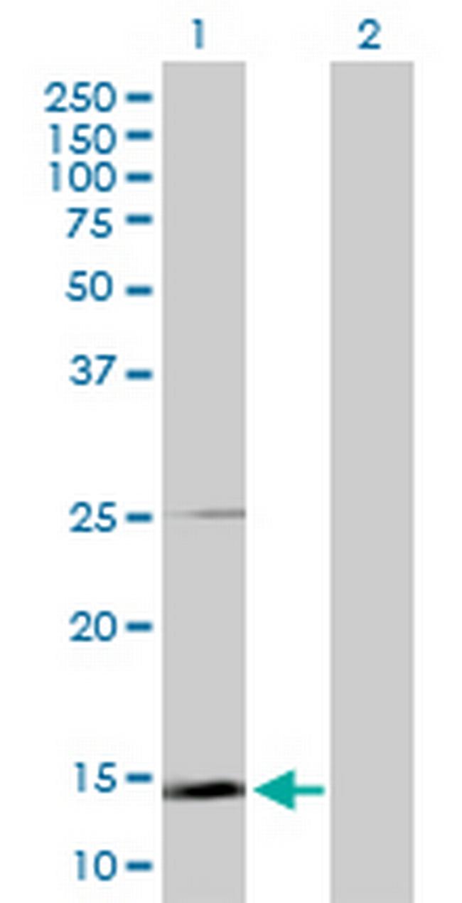 SCGB1A1 Antibody in Western Blot (WB)