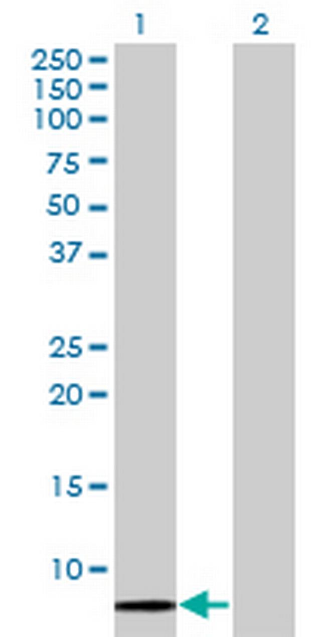 SCGB1A1 Antibody in Western Blot (WB)