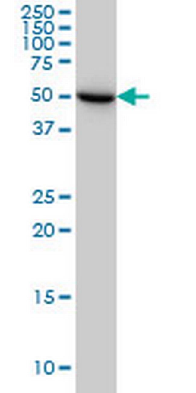 UGP2 Antibody in Western Blot (WB)