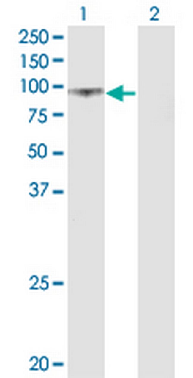 UMOD Antibody in Western Blot (WB)