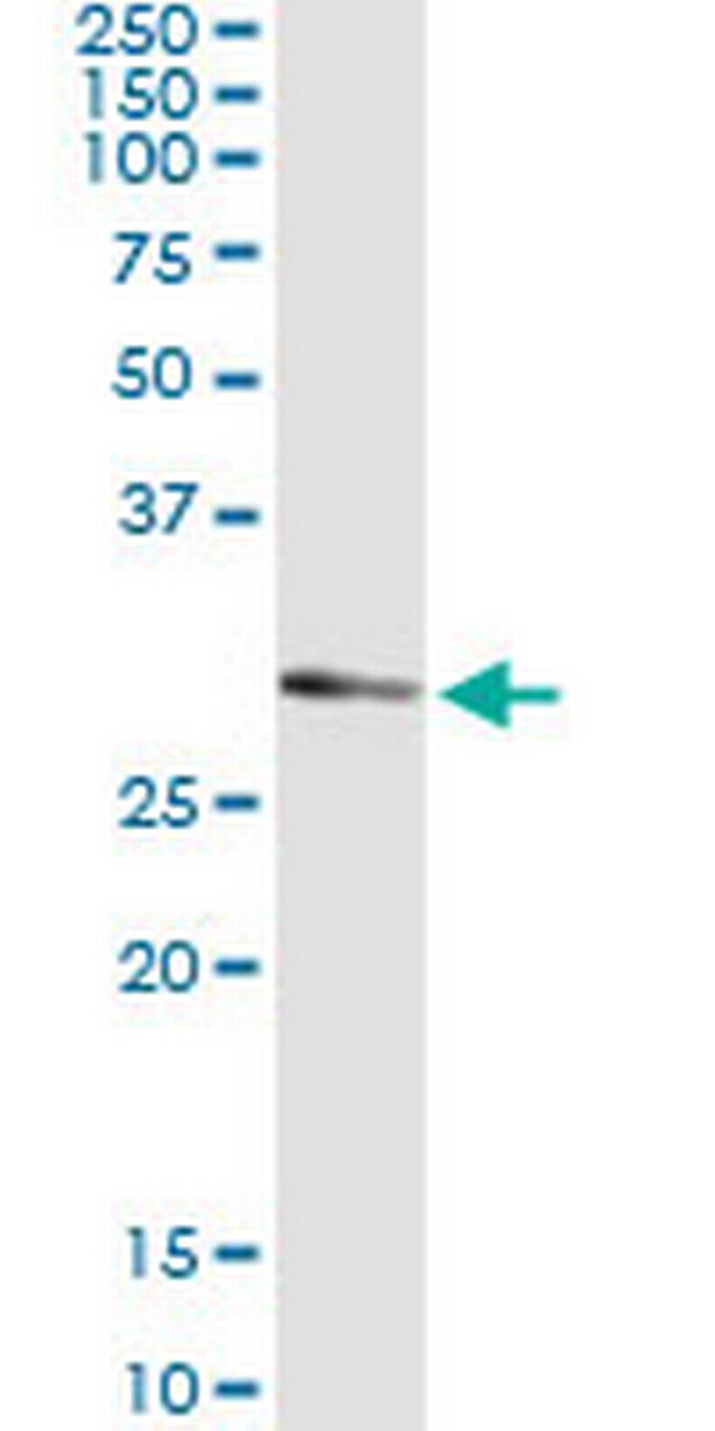 UCK2 Antibody in Immunoprecipitation (IP)