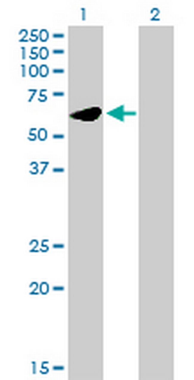 UMPS Antibody in Western Blot (WB)