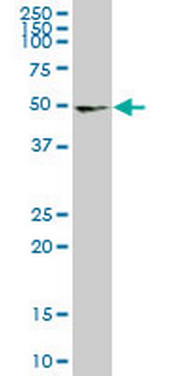 UMPS Antibody in Western Blot (WB)