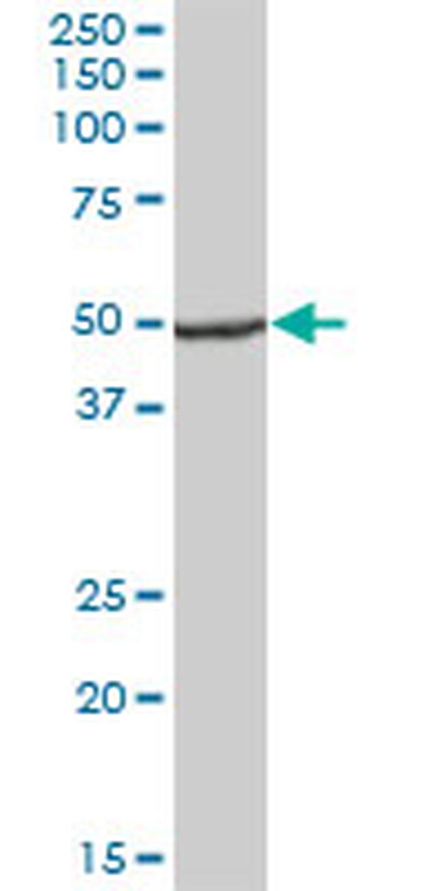 UQCRC1 Antibody in Western Blot (WB)