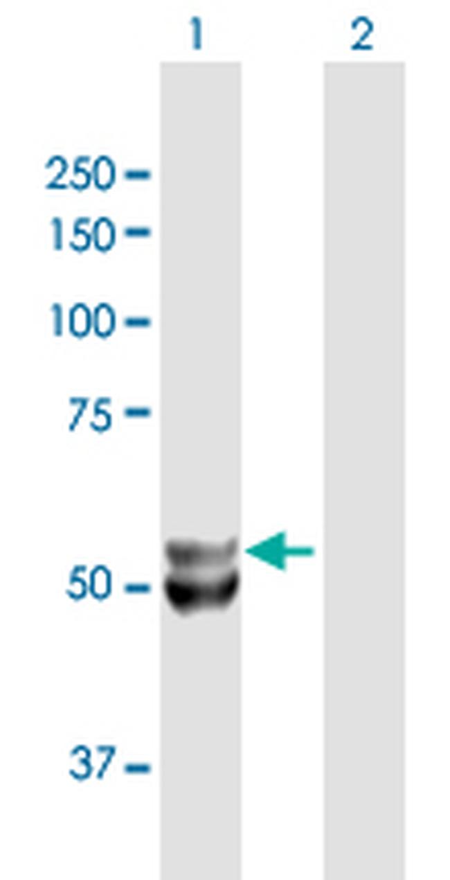 UQCRC1 Antibody in Western Blot (WB)