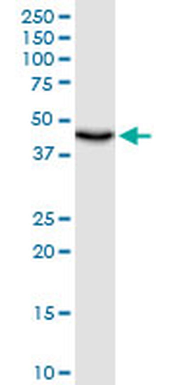 UQCRC1 Antibody in Western Blot (WB)