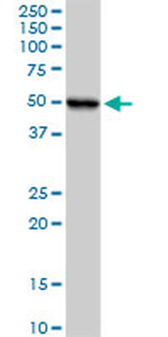 UQCRC1 Antibody in Western Blot (WB)