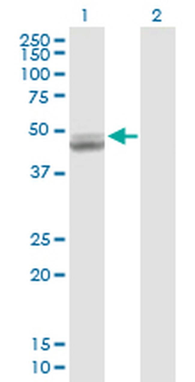 UQCRC1 Antibody in Western Blot (WB)