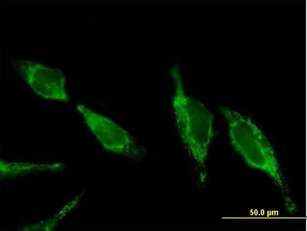 UQCRC2 Antibody in Immunocytochemistry (ICC/IF)