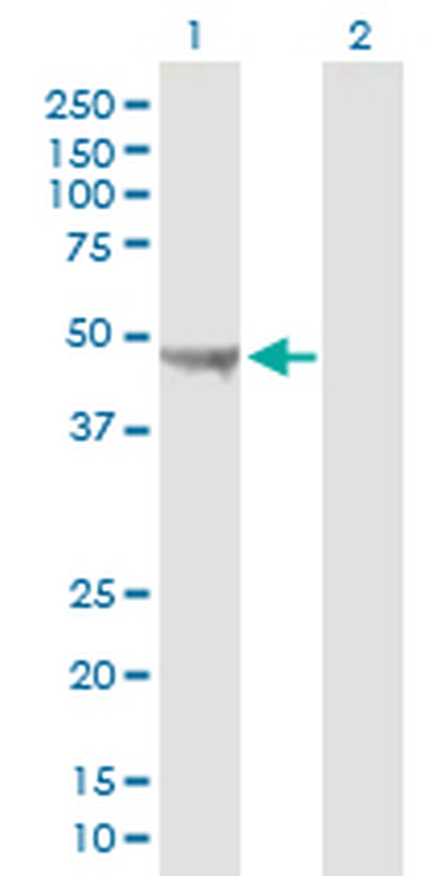 UQCRC2 Antibody in Western Blot (WB)