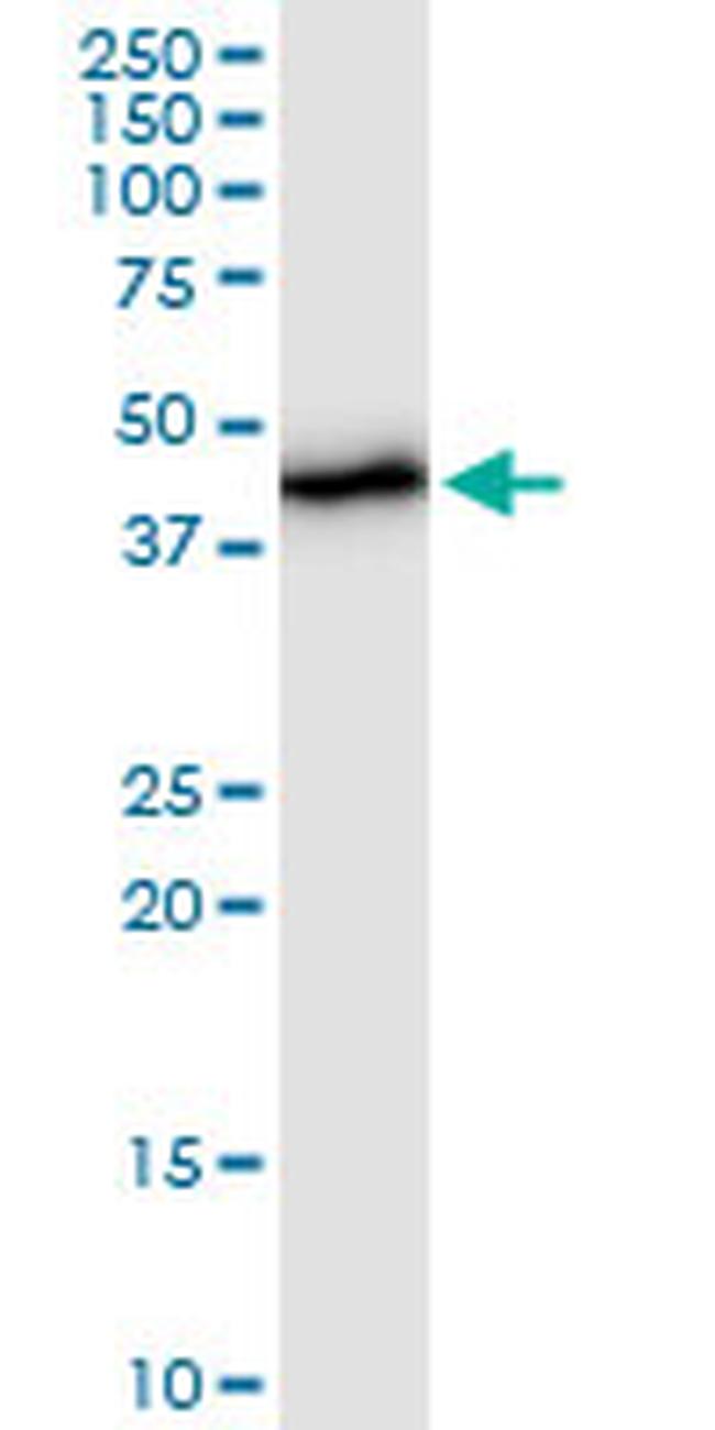 UQCRC2 Antibody in Western Blot (WB)