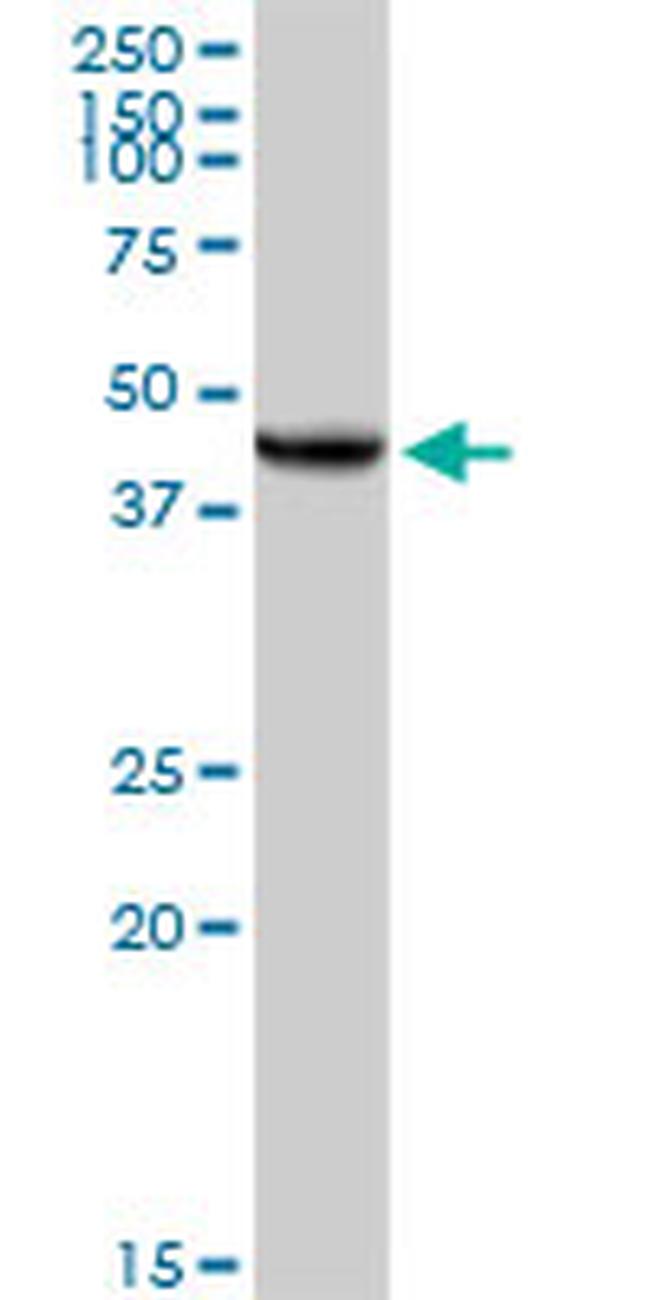 UQCRC2 Antibody in Western Blot (WB)