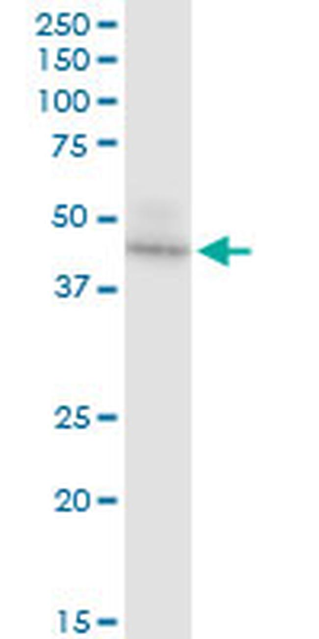 UQCRC2 Antibody in Western Blot (WB)