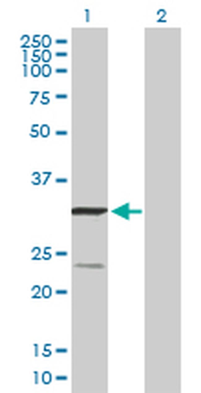 UQCRFS1 Antibody in Western Blot (WB)